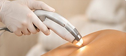 Hair Removal